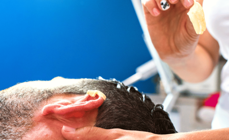 Why We Need Microsuction Ear Wax Removal Treatment