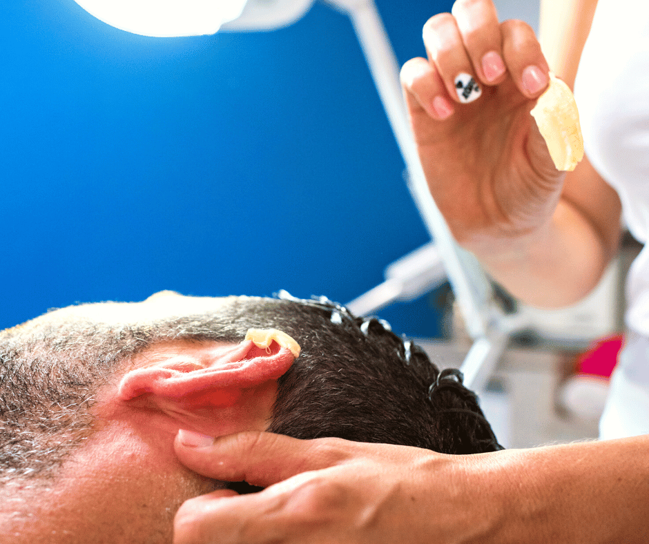 Why We Need Microsuction Ear Wax Removal Treatment?